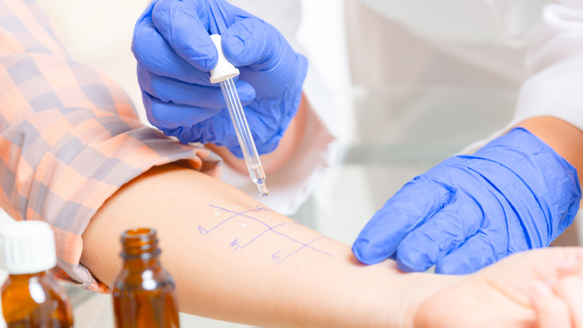 What isan Allergy and When is an Allergy Test Necessary?