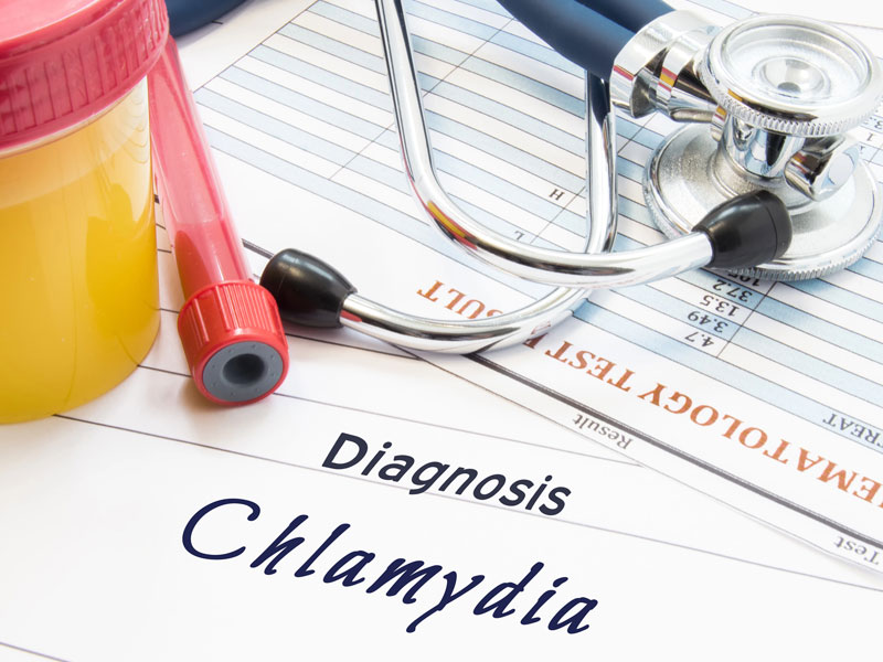 Urine sample, blood test results, and written diagnosis of chlamydia - to illustrate that an STD can cause infertility